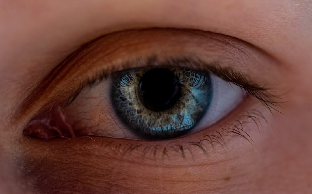 oog